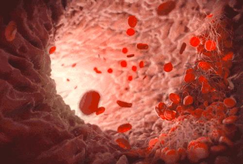 身体淤青自愈是什么病,最近身上出现淤青是怎么回事