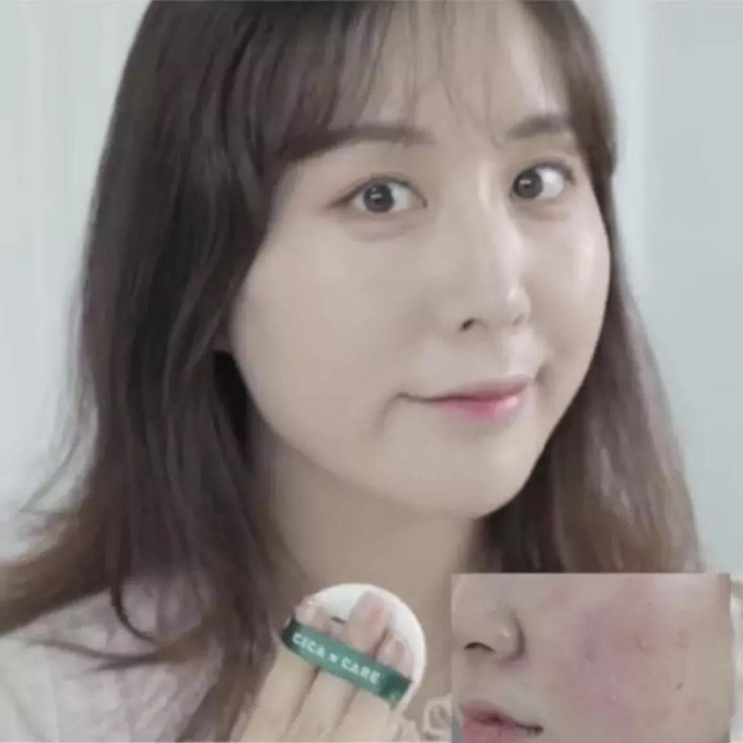 油痘敏感肌气垫推荐,混合皮敏感肌气垫推荐