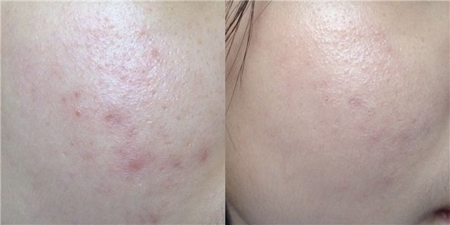 适合近距离的妆容,近距离妆容