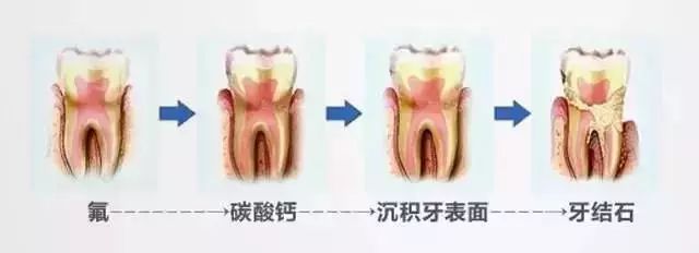 新西兰进口牙齿修复牙膏,保护牙龈萎缩的进口牙膏
