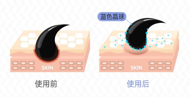 喷一喷,黑头油脂自动溶解!日本爆款清洁喷雾还你一个嫩*b嫩**aby肌!