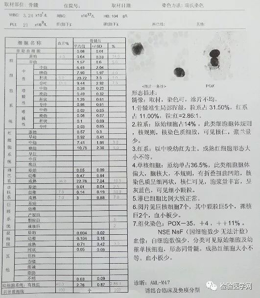 看懂血常规报告单只需明白这四项,宝宝做血常规要注意什么