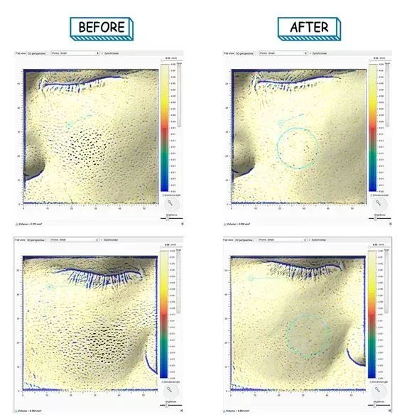 教你这样洗脸,洗脸虽简单也得好好对待