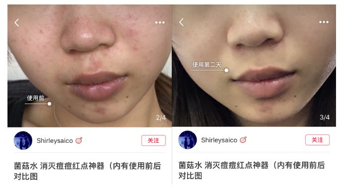 教你搞定肤色暗沉问题,肤色暗沉无光泽怎么改善