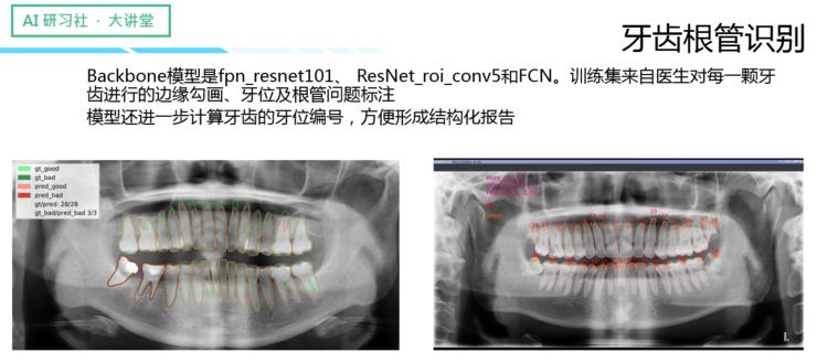 吴博：目标检测集成框架在医学图像AI辅助分析中的应用｜AI研习社第78期大讲堂