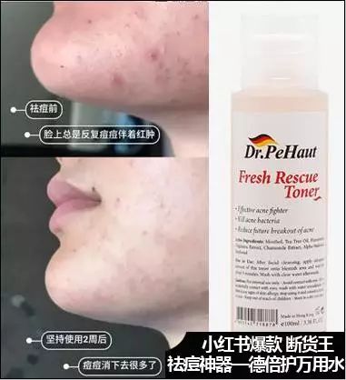 23岁后的女人用点好的！只需599元的SV冻龄水为何被誉为欧洲女性的驻颜神器？SV冻龄水胜于神仙水天然安全高效