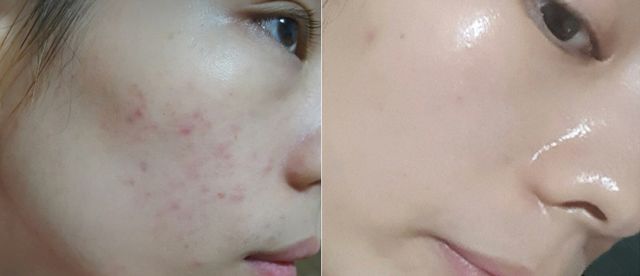 资生堂红腰子10ml小样直播,资生堂红腰子精华特价