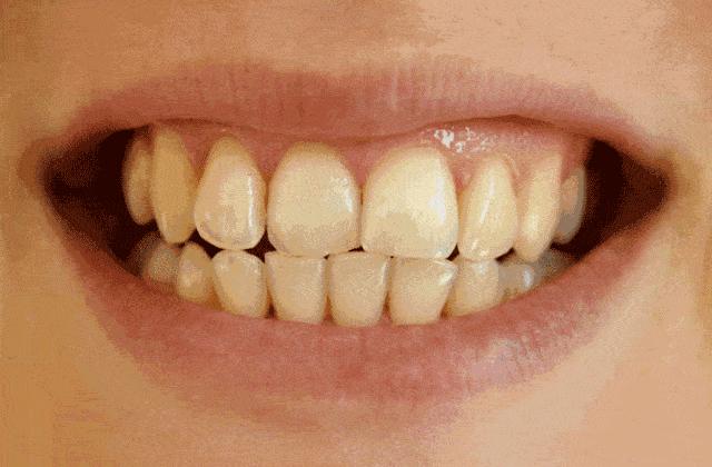 俄罗斯牙膏去黄牙怎么样,祛牙垢黄牙的牙膏国货之光