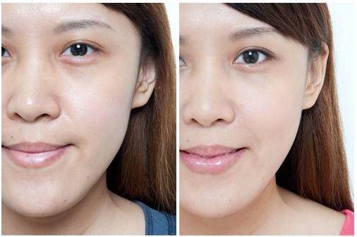 微晶法令纹贴抗皱纹提拉紧致面膜,淡纹抗皱法令纹面膜推荐