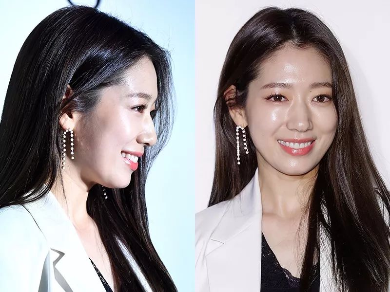 脖子为什么会有一道杠,脖子上出现几道杠会得什么病