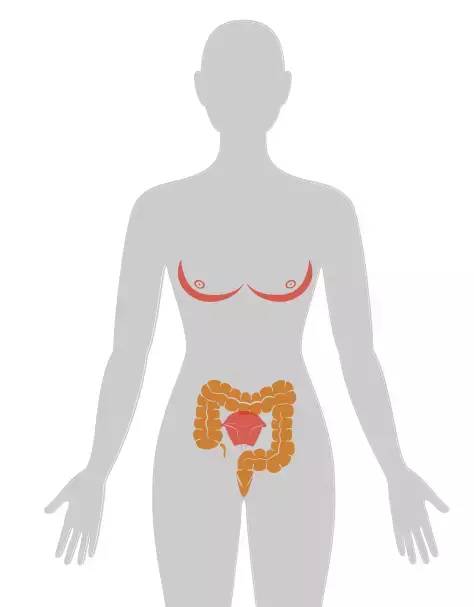 18张癌症人体地图，揭秘致癌真相！