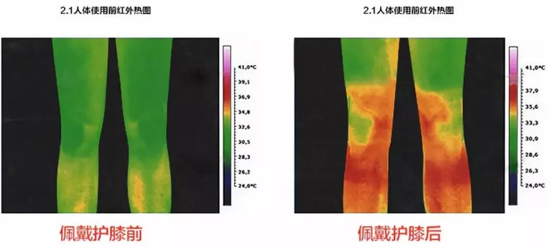 最好用的老寒腿护膝,日本老寒腿护膝