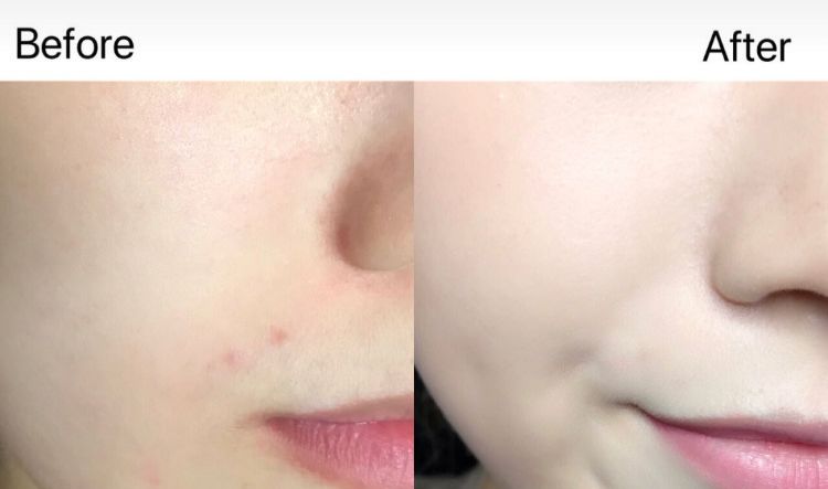 气垫推荐混干皮公认好用第一名,气垫推荐公认好用第一名黑黄皮