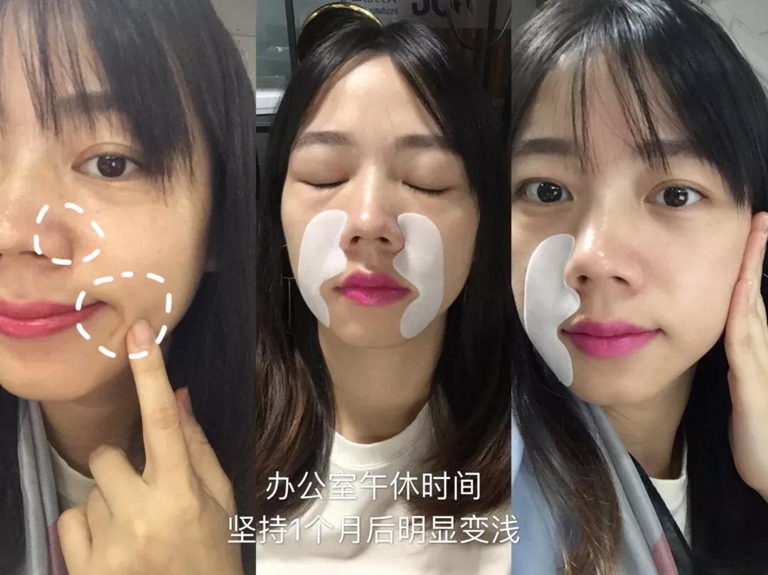 淡纹抗皱法令纹面膜推荐,法令纹面膜平价推荐