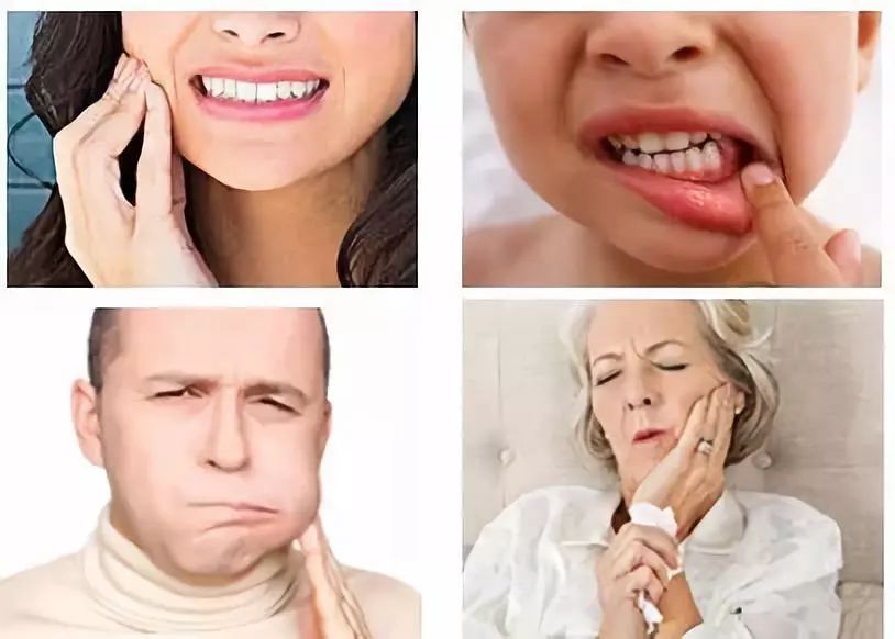 口腔溃疡10秒止疼草药,一秒止痛口腔溃疡