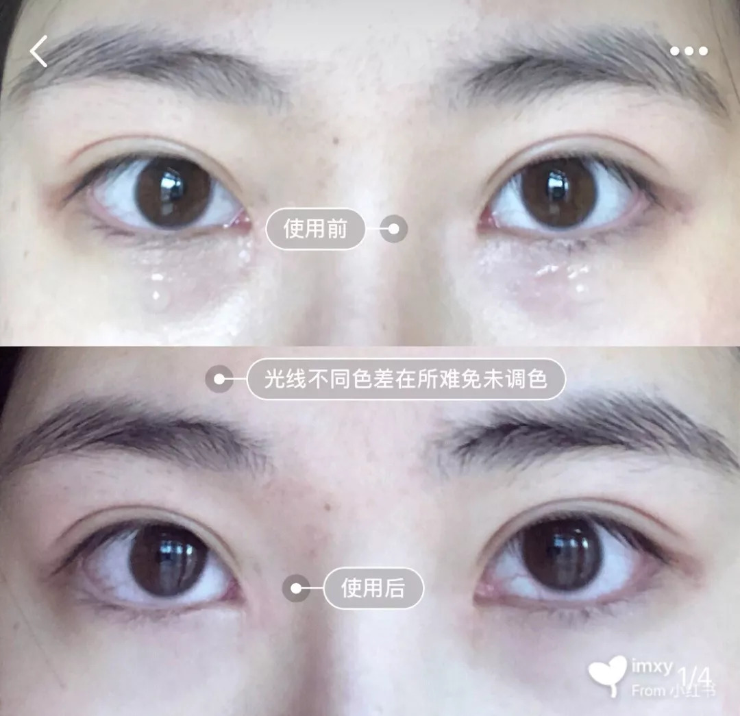 能去脂肪粒的眼霜,又能去纹又能去黑眼圈的眼霜