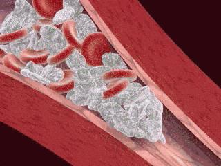 空气迅速降温喷雾,高温天气喷雾