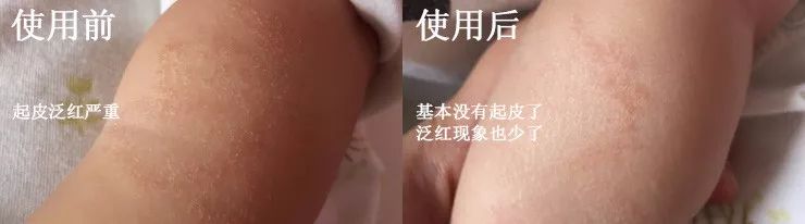 告别秋冬干燥肌肤,告别小糙脸