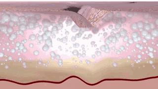 德国变态震动棒，啪啪啪间抚平眼袋、黑眼圈！不用开刀，就能让你年轻十岁！