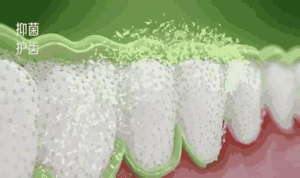 最好的口腔神器,好的去牙黄神器推荐