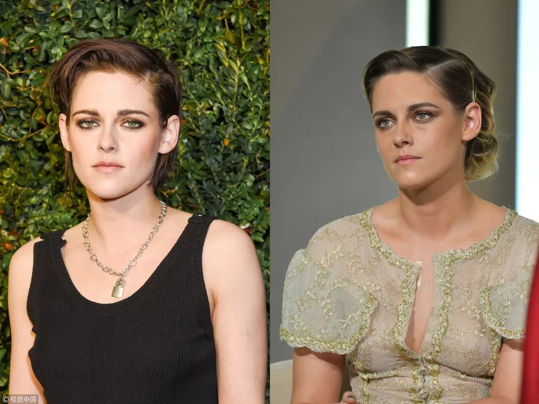 去掉眼袋之后天壤之别,无美颜无滤镜遮泪沟眼袋