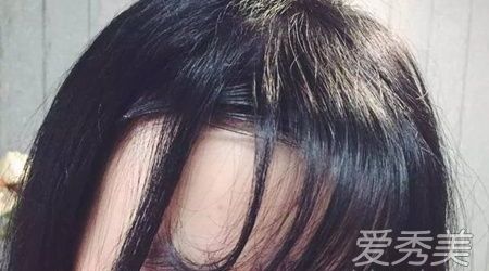 m型发际线前额稀少细软适合烫发,前额发际线低适合什么发型