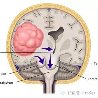 小不忍则乱大谋不可纠缠,小不忍则乱大谋不必理睬