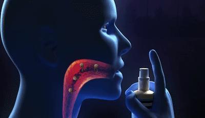 20年烟民咽喉发黑，瑞士专业医师推荐！一喷杀菌99.9%，止咳清痰排烟毒