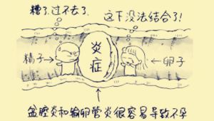 宫内孕合并宫外孕，医生护士协同作战降服病魔