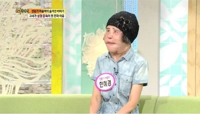 韩国整容毁容女逝去,整容电风扇大妈