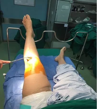 这群护士真牛！精通护理还会发明创造！有的作品还真适合在家里用哦！