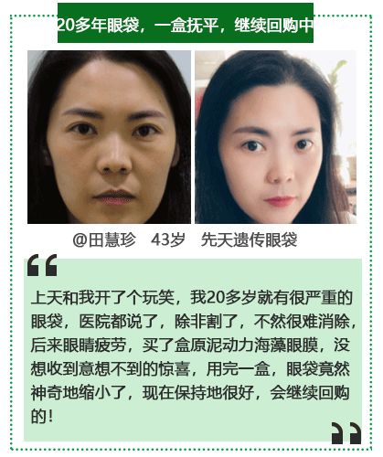 50岁没有眼袋眼纹黑眼圈,60岁去眼袋的最佳方法