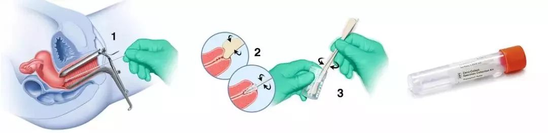 HPV疫苗摇不到号怎么办，完全佛系不在乎