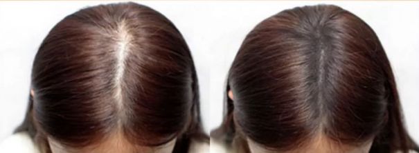 突然长了很多小碎发,额前碎发是新长出来的吗