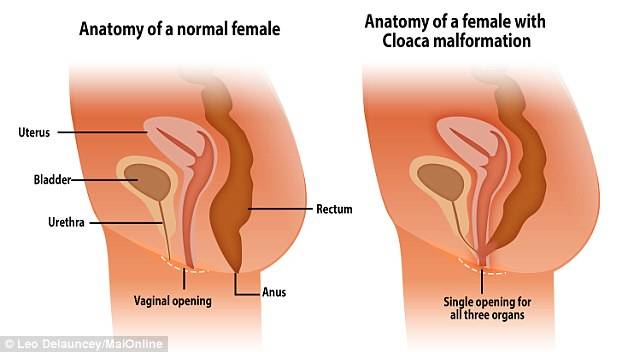 “走后门”也能怀孕？一个百万分之一的病例……