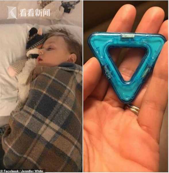 6岁小孩吞了圆形小磁铁,熊孩子贪玩吞钢珠磁铁