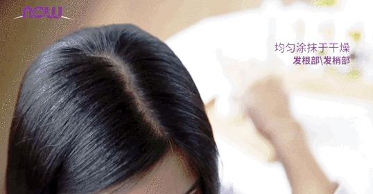 疯狂掉头发发际线后移,疯狂掉头发头发变得稀疏