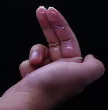 花式套套小盘点