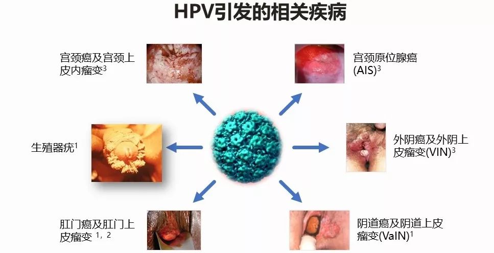 高危型hpv阳性可以切除子宫吗,子宫已切除hpv73还是阳性