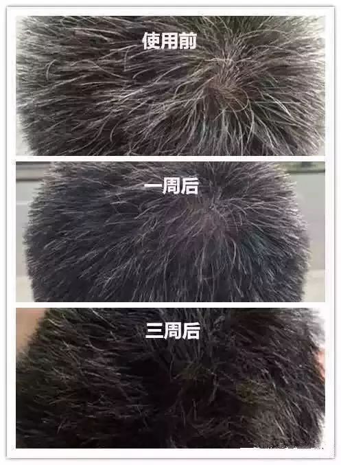 澳洲纯天然植物染发剂,纯天然不伤头发的染发剂