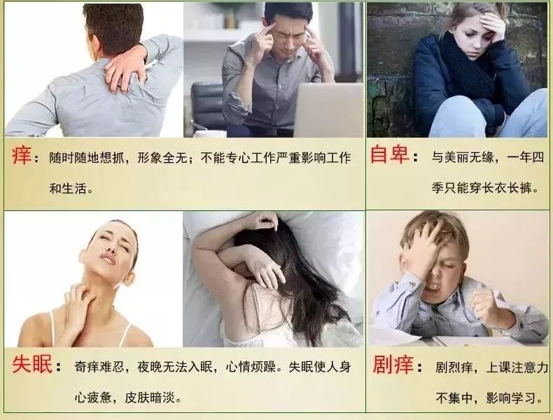 清凉止痒防暑醒神膏,止痒的草药膏