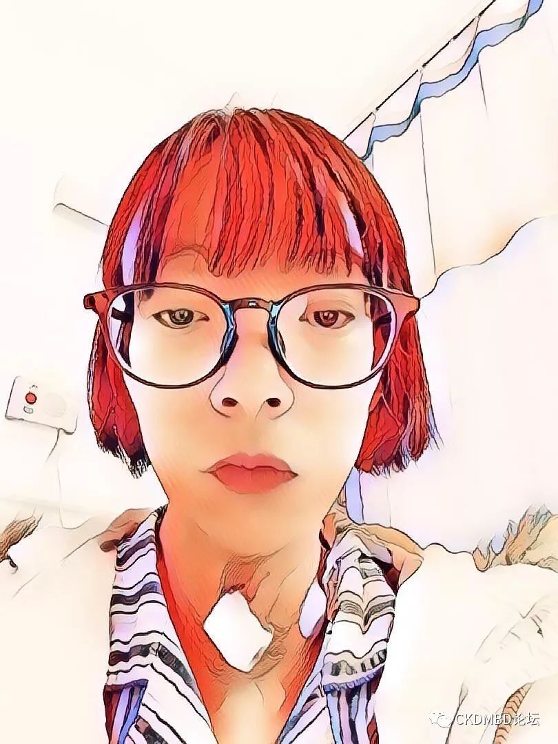 甲状旁腺射频消融术的全过程,后悔做甲状旁腺射频消融