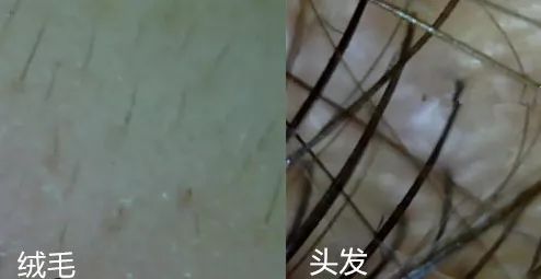 突然长了很多小碎发,额前碎发是新长出来的吗