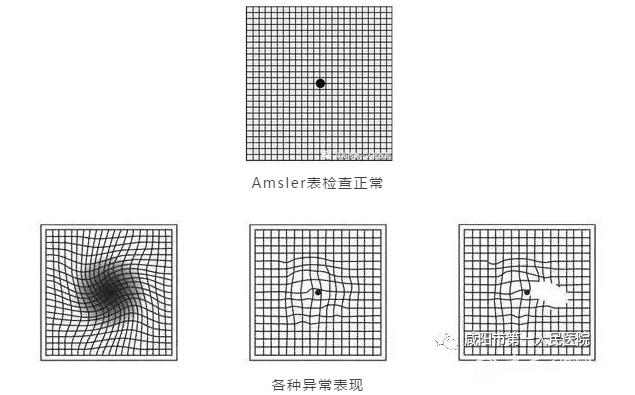 咸阳第一人民医院眼睛手术,咸阳市第一人民医院眼科飞秒手术