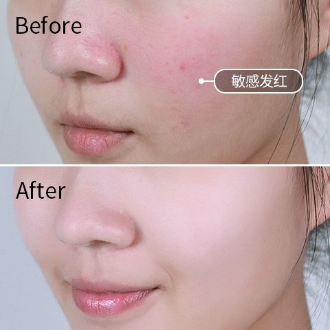 老公嫌老婆丑我们有小三怎么办,老公嫌我丑找小三