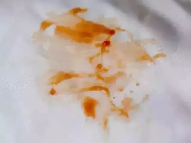 羽绒服脏了怎么局部干洗,羽绒服脏了怎么干洗最好