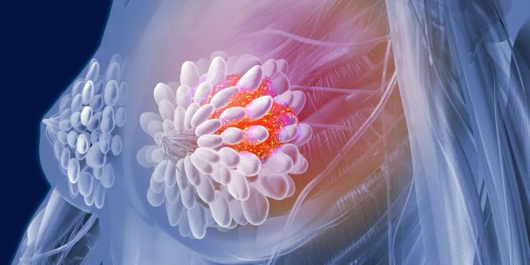 胸痛做b超挂什么科,胸痛应该挂什么科