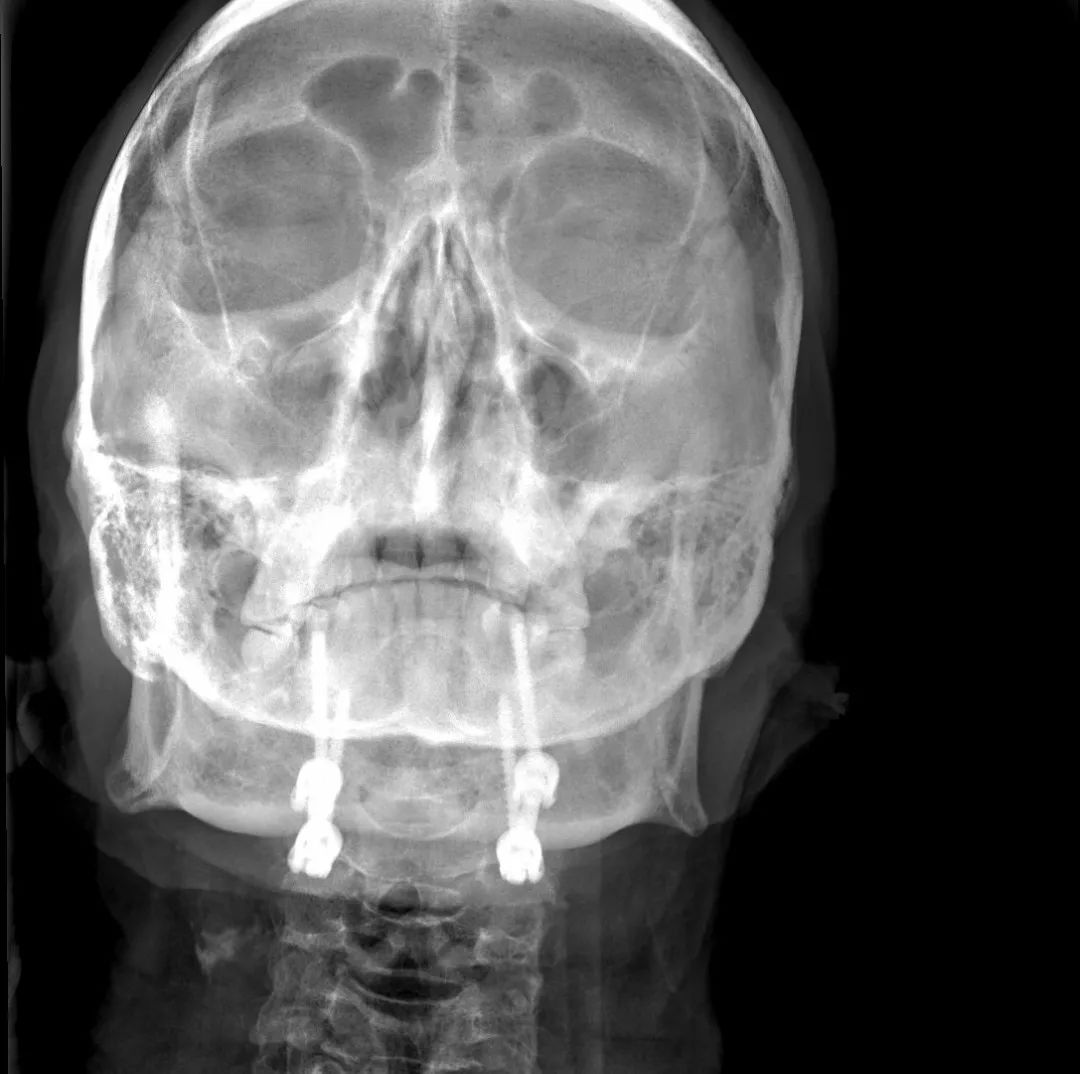 鍕囬棷鐢熷懡绂佸尯鍖婚櫌,鍕囬棷鐢熷懡绂佸尯浜旀鍙仠鎵嬫湳