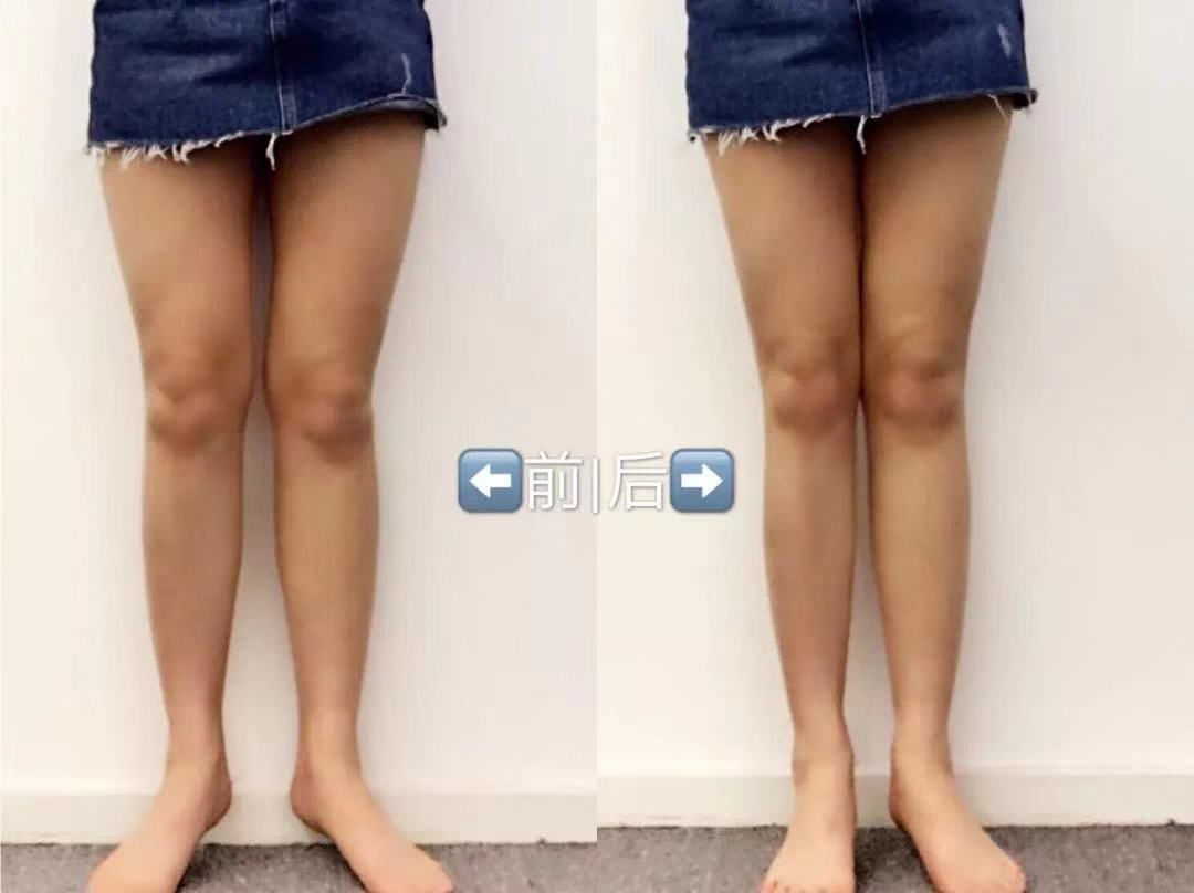 10倍燃烧卡路里！意大利夜光魔力裤，看得见的燃脂，30天还你超模腿！