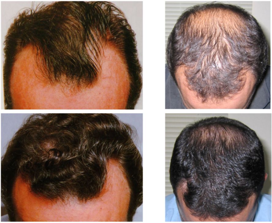 想为颜值偷偷加分？但只有10%的人会机智地修饰这里诶！